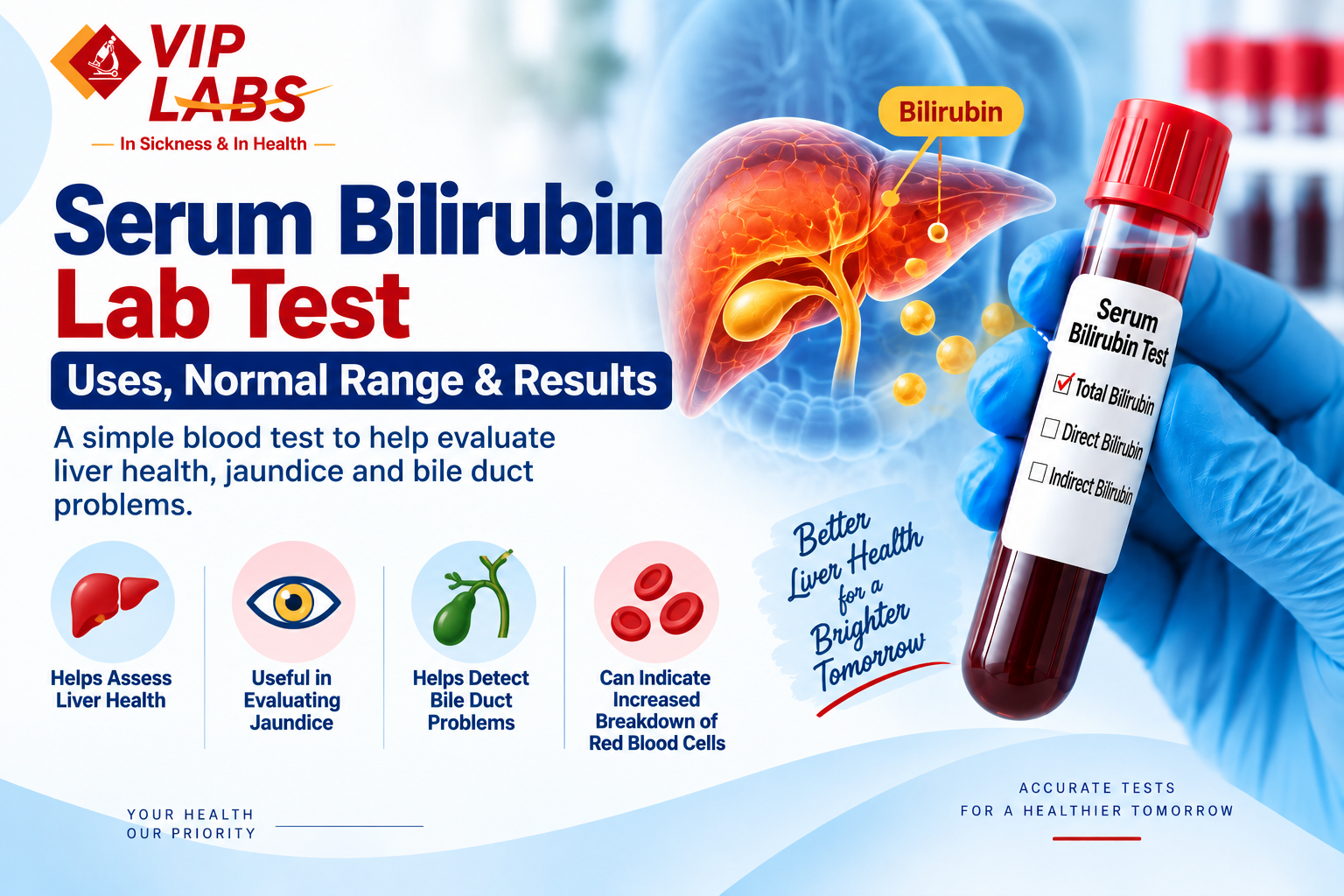 Serum Bilirubin Lab Test